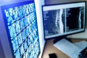 DICOM Transfer Syntax A Detailed Overview - Presented by PostDICOM